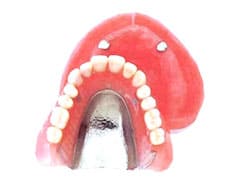 マグネット義歯